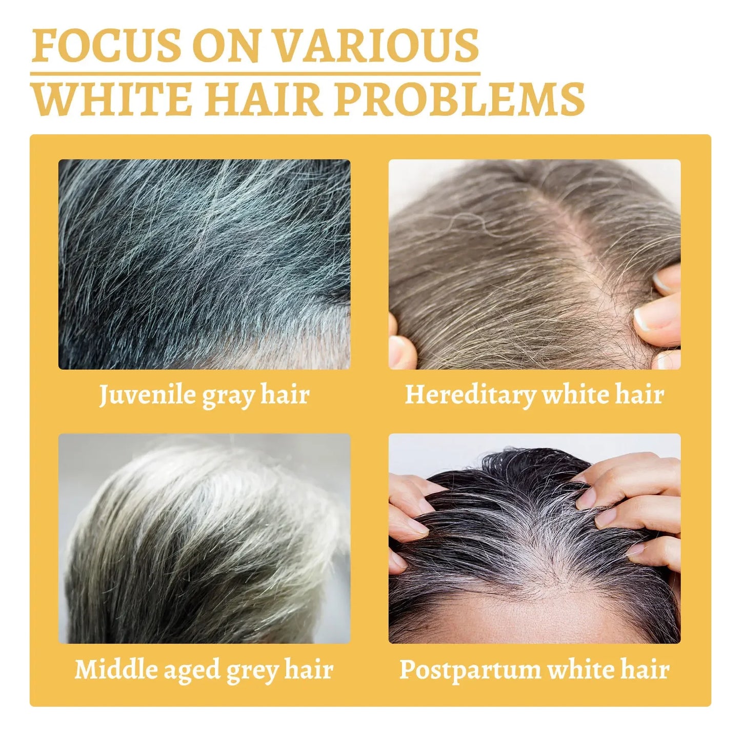 Gray to Natural Hair Serum — Anti-Loss Treatment for Men