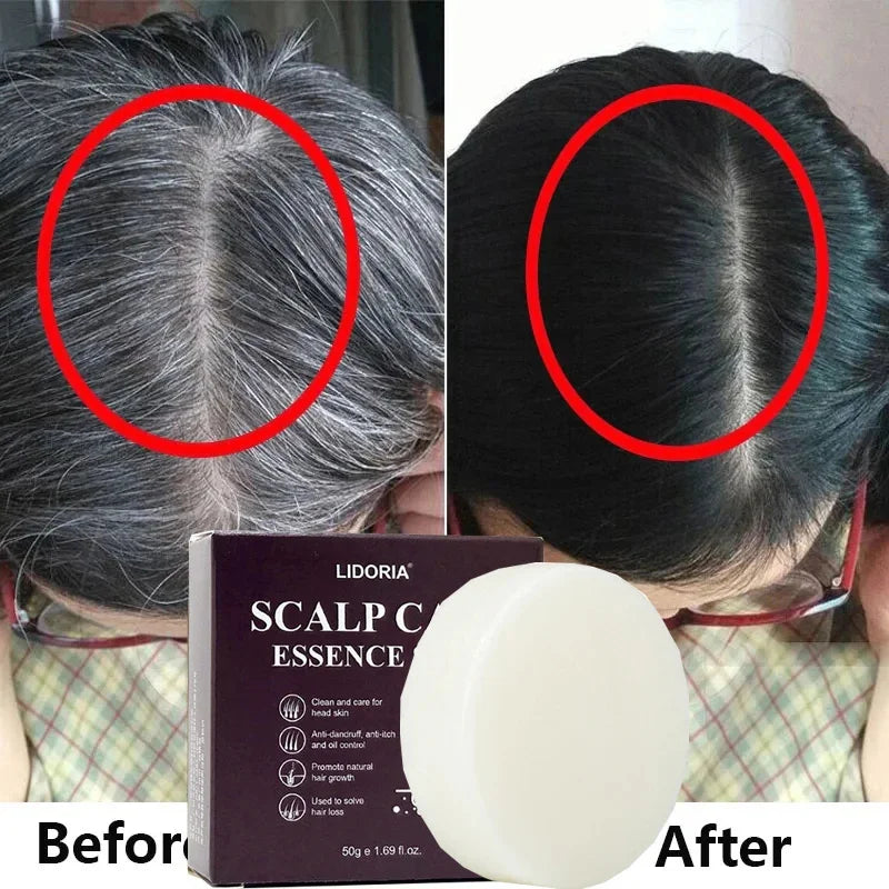Gray-to-Black Hair Treatment Serum & Shampoo Bar