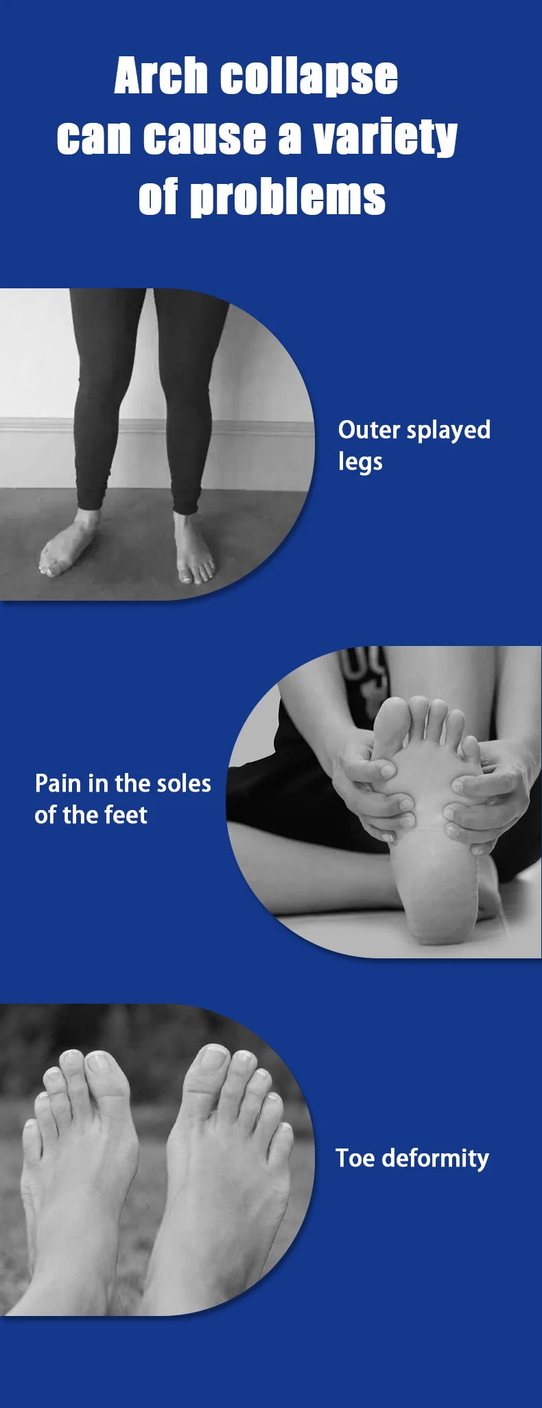 Orthopedic Arch Support Insoles – Flat Foot Relief & Comfort for Men & Women