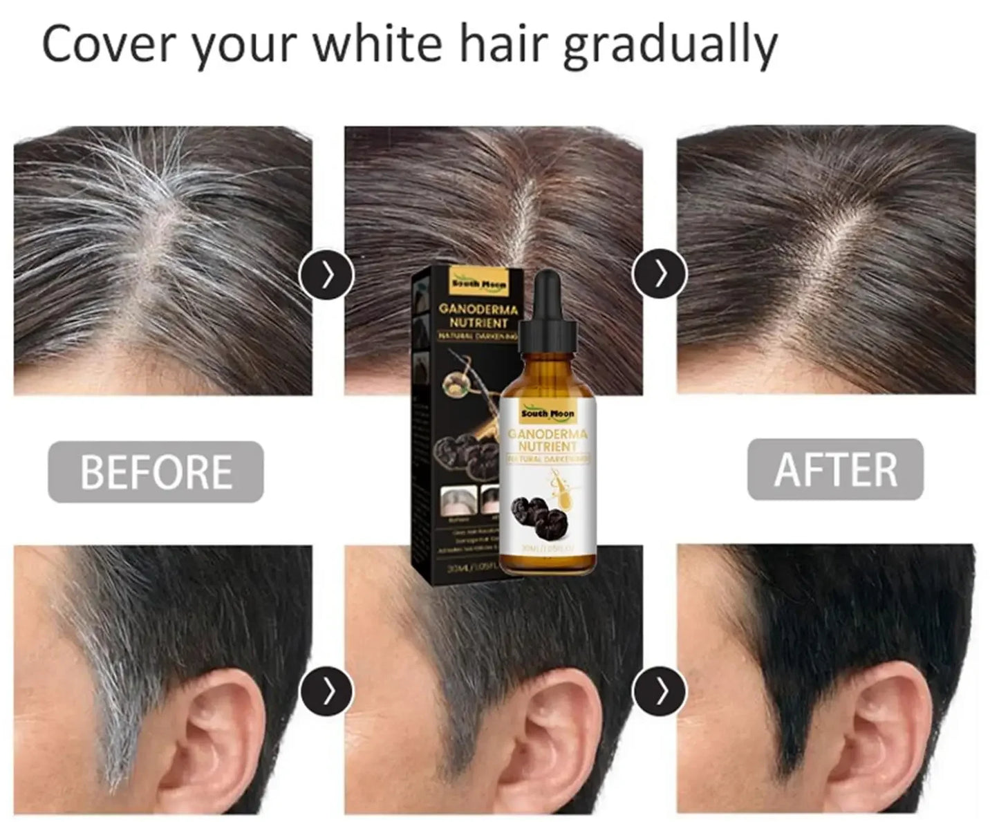 Gray to Natural Hair Serum — Anti-Loss Treatment for Men