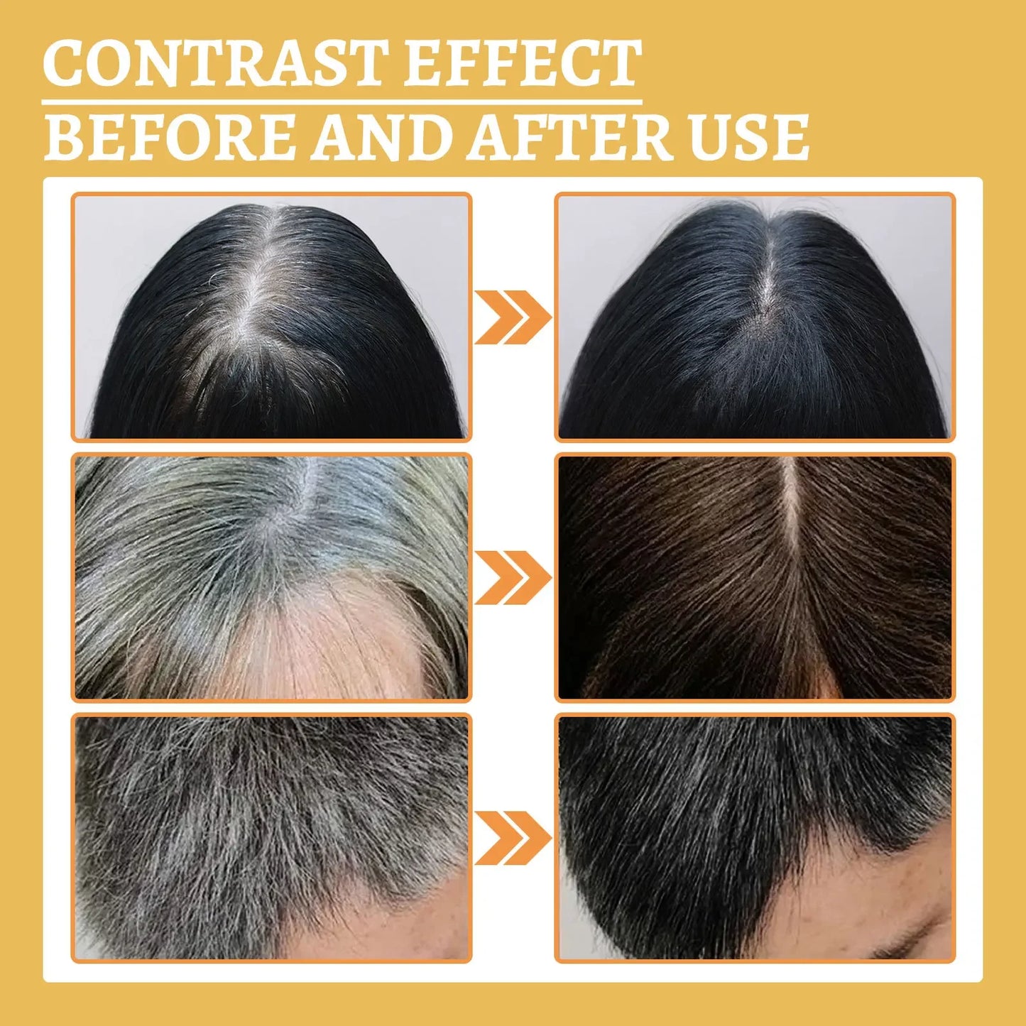 Gray to Natural Hair Serum — Anti-Loss Treatment for Men