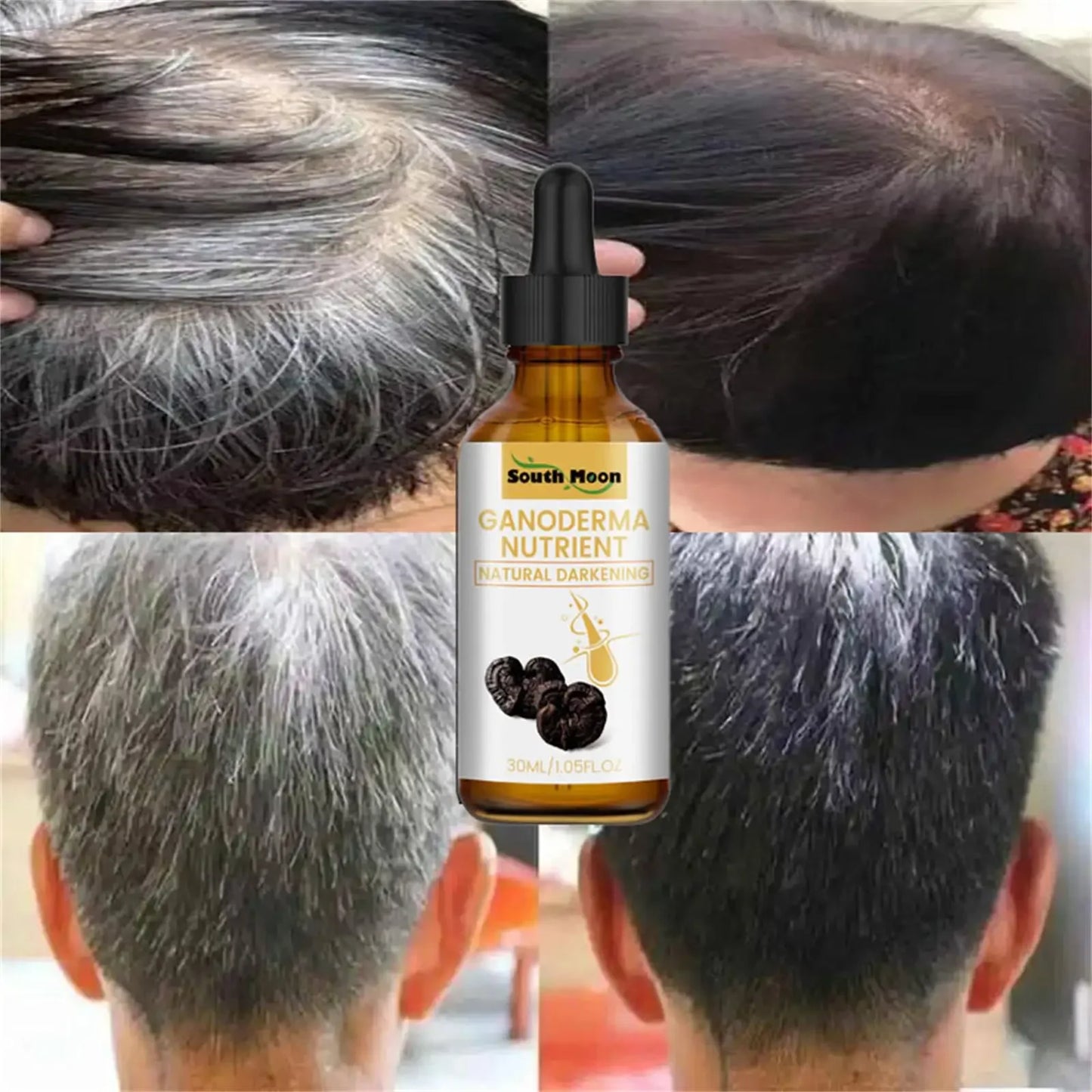 Gray to Natural Hair Serum — Anti-Loss Treatment for Men
